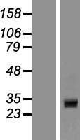CCDC24 Protein - Western validation with an anti-DDK antibody * L: Control HEK293 lysate R: Over-expression lysate