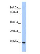 CCDC27 Antibody - CCDC27 antibody Western Blot of Fetal Liver. Antibody dilution: 1 ug/ml.  This image was taken for the unconjugated form of this product. Other forms have not been tested.
