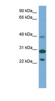 CCDC28A Antibody - CCDC28A antibody Western blot of Fetal Muscle lysate. This image was taken for the unconjugated form of this product. Other forms have not been tested.