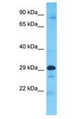 CCDC28A Antibody - CCDC28A antibody Western Blot of A549. Antibody dilution: 1 ug/ml.  This image was taken for the unconjugated form of this product. Other forms have not been tested.