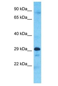 CCDC28A Antibody - CCDC28A antibody Western Blot of A549. Antibody dilution: 1 ug/ml.  This image was taken for the unconjugated form of this product. Other forms have not been tested.