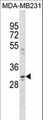 CCDC28A Antibody - CCDC28A Antibody western blot of MDA-MB231 cell line lysates (35 ug/lane). The CCDC28A Antibody detected the CCDC28A protein (arrow).