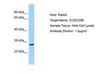 CCDC28B Antibody -  This image was taken for the unconjugated form of this product. Other forms have not been tested.