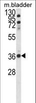 CCDC3 Antibody - Western blot of CCDC3 Antibody in mouse bladder tissue lysates (35 ug/lane). CCDC3 (arrow) was detected using the purified antibody.