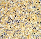 CCDC3 Antibody - Formalin-fixed and paraffin-embedded human spleen reacted with CCDC3 Antibody , which was peroxidase-conjugated to the secondary antibody, followed by DAB staining. This data demonstrates the use of this antibody for immunohistochemistry; clinical relevance has not been evaluated.