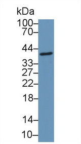 CCDC3 Antibody - Western Blot; Sample: Mouse Gallbladder lysate; ;Primary Ab: 1µg/ml Rabbit Anti-Human CCDC3 Antibody;Second Ab: 0.2µg/mL HRP-Linked Caprine Anti-Rabbit IgG Polyclonal Antibody;