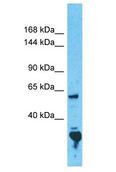 CCDC30 Antibody - CCDC30 antibody Western Blot of 293T. Antibody dilution: 1 ug/ml.  This image was taken for the unconjugated form of this product. Other forms have not been tested.