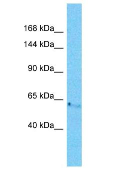 CCDC30 Antibody - CCDC30 antibody Western Blot of ACHN. Antibody dilution: 1 ug/ml.  This image was taken for the unconjugated form of this product. Other forms have not been tested.