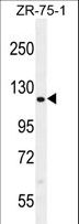 CCDC33 Antibody - CCD33 Antibody western blot of ZR-75-1 cell line lysates (35 ug/lane). The CCD33 antibody detected the CCD33 protein (arrow).