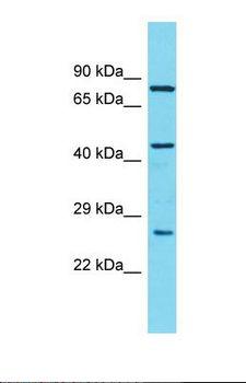 CCDC34 Antibody - Western blot of Human OVCAR-3. CCDC34 antibody dilution 1.0 ug/ml.  This image was taken for the unconjugated form of this product. Other forms have not been tested.