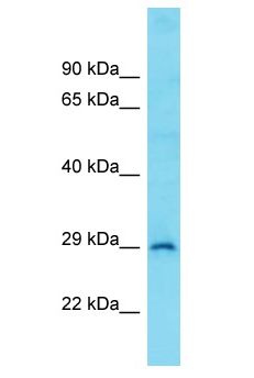 CCDC34 Antibody - CCDC34 antibody Western Blot of COLO205. Antibody dilution: 1 ug/ml.  This image was taken for the unconjugated form of this product. Other forms have not been tested.