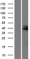 CCDC34 Protein - Western validation with an anti-DDK antibody * L: Control HEK293 lysate R: Over-expression lysate