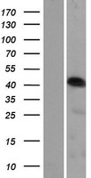 CCDC34 Protein - Western validation with an anti-DDK antibody * L: Control HEK293 lysate R: Over-expression lysate