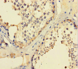 CCDC36 Antibody - Immunohistochemistry of paraffin-embedded human testis tissue using CCDC36 Antibody at dilution of 1:100