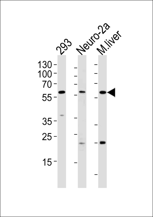 CCDC36 Antibody - Western blot of lysates from 293,Neuro-2a cell line and mouse liver tissue (from left to right),using CCDC36 Antibody. Antibody was diluted at 1:1000 at each lane. A goat anti-rabbit IgG H&L (HRP) at 1:5000 dilution was used as the secondary antibody.Lysates at 35ug per lane.