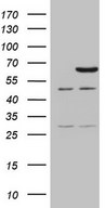 CCDC36 Antibody - HEK293T cells were transfected with the pCMV6-ENTRY control (Left lane) or pCMV6-ENTRY CCDC36 (Right lane) cDNA for 48 hrs and lysed. Equivalent amounts of cell lysates (5 ug per lane) were separated by SDS-PAGE and immunoblotted with anti-CCDC36 (1:2000).