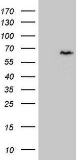 CCDC36 Antibody - HEK293T cells were transfected with the pCMV6-ENTRY control. (Left lane) or pCMV6-ENTRY CCDC36. (Right lane) cDNA for 48 hrs and lysed. Equivalent amounts of cell lysates. (5 ug per lane) were separated by SDS-PAGE and immunoblotted with anti-CCDC36. (1:2000)