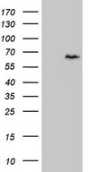 CCDC36 Antibody - HEK293T cells were transfected with the pCMV6-ENTRY control. (Left lane) or pCMV6-ENTRY CCDC36. (Right lane) cDNA for 48 hrs and lysed