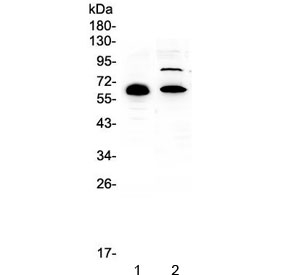 CCDC36 Antibody - Western blot testing of human 1) placenta and 2) HL-60 lysate with CCDC36 antibody at 0.5ug/ml. Predicted molecular weight ~66 kDa.
