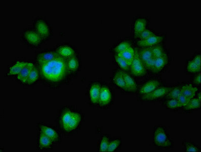 CCDC37 Antibody - Immunofluorescent analysis of HepG2 cells using CFAP100 Antibody at dilution of 1:100 and Alexa Fluor 488-congugated AffiniPure Goat Anti-Rabbit IgG(H+L)