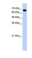 CCDC38 Antibody - CCDC38 antibody Western blot of Transfected 293T cell lysate. This image was taken for the unconjugated form of this product. Other forms have not been tested.