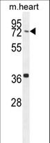 CCDC38 Antibody - CCDC38 Antibody western blot of mouse heart tissue lysates (35 ug/lane). The CCDC38 antibody detected the CCDC38 protein (arrow).