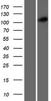 CCDC39 Protein - Western validation with an anti-DDK antibody * L: Control HEK293 lysate R: Over-expression lysate