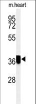 CCDC42 Antibody - Western blot of CCDC42 Antibody in mouse heart tissue lysates (35 ug/lane). CCDC42 (arrow) was detected using the purified antibody.