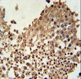 CCDC42 Antibody - CCDC42 Antibody immunohistochemistry of formalin-fixed and paraffin-embedded human testis tissue followed by peroxidase-conjugated secondary antibody and DAB staining.