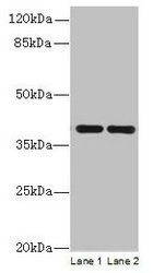 CCDC42 Antibody - Western blot All lanes: CCDC42 antibody at 0.8µg/ml Lane 1: Mouse brain tissue Lane 2: Mouse heart tissue Secondary Goat polyclonal to rabbit IgG at 1/10000 dilution Predicted band size: 39, 30 kDa Observed band size: 39 kDa
