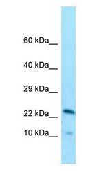 CCDC43 Antibody - CCDC43 antibody Western Blot of Human Small Intestine.  This image was taken for the unconjugated form of this product. Other forms have not been tested.