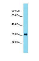 CCDC44 / TACO1 Antibody - Western blot of Rat Liver. Taco1 antibody dilution 1.0 ug/ml.  This image was taken for the unconjugated form of this product. Other forms have not been tested.