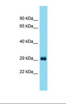 CCDC44 / TACO1 Antibody - Western blot of Rat Liver. Taco1 antibody dilution 1.0 ug/ml.  This image was taken for the unconjugated form of this product. Other forms have not been tested.