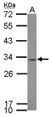 CCDC44 / TACO1 Antibody - Sample (30 ug of whole cell lysate) A: IMR32 12% SDS PAGE TACO1 / CCDC44 antibody diluted at 1:1000
