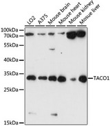 CCDC44 / TACO1 Antibody - Western blot analysis of extracts of various cell lines, using TACO1 antibody at 1:1000 dilution. The secondary antibody used was an HRP Goat Anti-Rabbit IgG (H+L) at 1:10000 dilution. Lysates were loaded 25ug per lane and 3% nonfat dry milk in TBST was used for blocking. An ECL Kit was used for detection and the exposure time was 90s.
