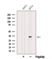 CCDC44 / TACO1 Antibody - Western blot analysis of extracts of HeLa cells using TACO1/CCDC44 antibody. The lane on the left was treated with blocking peptide.