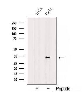 CCDC44 / TACO1 Antibody - Western blot analysis of extracts of HeLa cells using TACO1/CCDC44 antibody. The lane on the left was treated with blocking peptide.