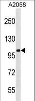 CCDC46 Antibody - CCDC46 Antibody western blot of A2058 cell line lysates (35 ug/lane). The CCDC46 antibody detected the CCDC46 protein (arrow).