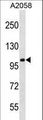 CCDC46 Antibody - CCDC46 Antibody western blot of A2058 cell line lysates (35 ug/lane). The CCDC46 antibody detected the CCDC46 protein (arrow).