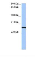 CCDC46 Antibody - HepG2 cell lysate. Antibody concentration: 1.0 ug/ml. Gel concentration: 12%.  This image was taken for the unconjugated form of this product. Other forms have not been tested.