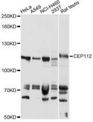CCDC46 Antibody - Western blot analysis of extracts of various cell lines, using CEP112 antibody at 1:1000 dilution. The secondary antibody used was an HRP Goat Anti-Rabbit IgG (H+L) at 1:10000 dilution. Lysates were loaded 25ug per lane and 3% nonfat dry milk in TBST was used for blocking. An ECL Kit was used for detection and the exposure time was 60s.