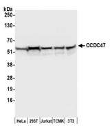 CCDC47 Antibody - Detection of human and mouse CCDC47 by western blot. Samples: Whole cell lysate (50 µg) from HeLa, HEK293T, Jurkat, mouse TCMK-1, and mouse NIH 3T3 cells prepared using NETN lysis buffer. Antibody: Affinity purified rabbit anti-CCDC47 antibody used for WB at 0.1 µg/ml. Detection: Chemiluminescence with an exposure time of 3 seconds.