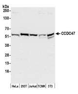 CCDC47 Antibody - Detection of human and mouse CCDC47 by western blot. Samples: Whole cell lysate (50 µg) from HeLa, HEK293T, Jurkat, mouse TCMK-1, and mouse NIH 3T3 cells prepared using NETN lysis buffer. Antibody: Affinity purified rabbit anti-CCDC47 antibody used for WB at 0.1 µg/ml. Detection: Chemiluminescence with an exposure time of 10 seconds.