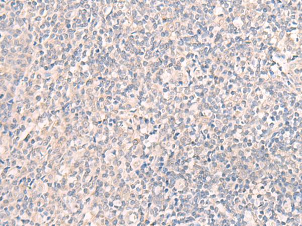 CCDC47 Antibody - Immunohistochemistry of paraffin-embedded Human tonsil tissue  using CCDC47 Polyclonal Antibody at dilution of 1:25(×200)