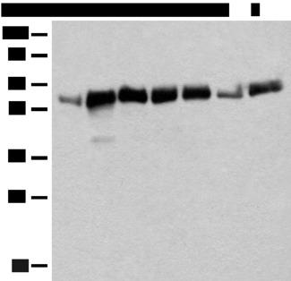 CCDC47 Antibody - Western blot analysis of Mouse heart tissue Mouse liver tissue NIH/3T3 cell Human bladder transitional cell carcinoma grade 2-3 tissue A172 cell Human placenta tissue K562 cell lysates  using CCDC47 Polyclonal Antibody at dilution of 1:350