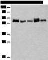 CCDC47 Antibody - Western blot analysis of K562 and A172 cell Human bladder transitional cell carcinoma grade 2-3 tissue NIH/3T3 cell Mouse liver tissue lysates  using CCDC47 Polyclonal Antibody at dilution of 1:300