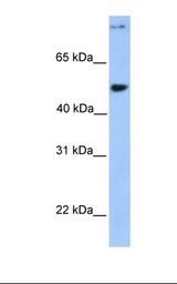 CCDC50 Antibody - 721_B cell lysate. Antibody concentration: 1.0 ug/ml. Gel concentration: 12%.  This image was taken for the unconjugated form of this product. Other forms have not been tested.