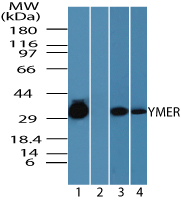 CCDC50 Antibody - Western blot of Chromosome 3 open reading frame 6 (YMER) in human skeletal muscle lysate in the 1) absence, 2) presence of immunizing peptide, 3) mouse skeletal muscle and 4) rat skeletal muscle lysate using Peptide-affinity Purified Polyclonal Antibody to Chromosome 3 open reading frame 6 (YMER) at 0.05 ug/ml, 0.25 ug/ml and 0.25 ug/ml respectively.