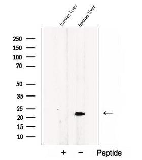 CCDC53 Antibody - Western blot analysis of extracts of human liver tissue using CCDC53 antibody. The lane on the left was treated with blocking peptide.