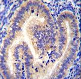 CCDC54 Antibody - CCDC54 Antibody immunohistochemistry of formalin-fixed and paraffin-embedded human uterus tissue followed by peroxidase-conjugated secondary antibody and DAB staining.